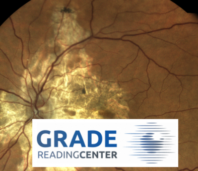 Bild vom Augenhintergrund und Logo des GRADE Reading Centers